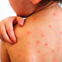 NC's festival reception underway in Sanepa