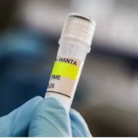 ‘Cancer patients often do better with less intensive treatment’