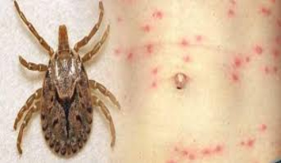 386 cases of Scrub Typhus detected in Chitwan