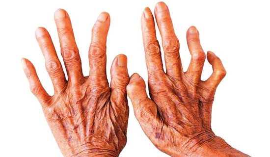 Banke at high risk of leprosy