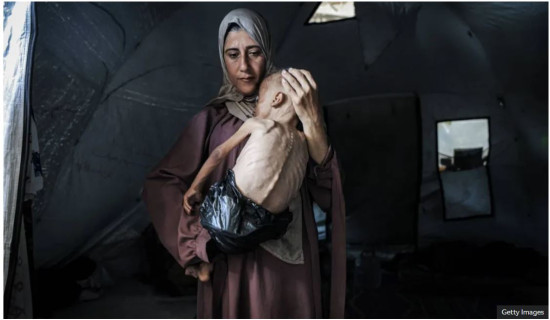 Gazans 'wasting away' as mass starvation spreads, humanitarian groups warn