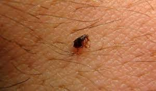 Scrub typhus cases on the rising trend in Chitwan