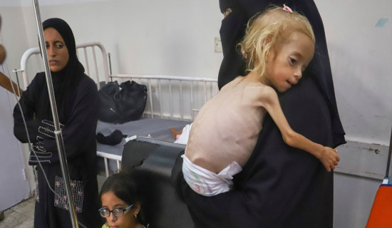 Gaza kids suffer from extreme malnutrition