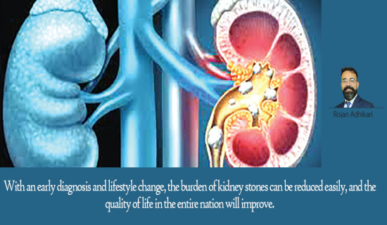 Beat Kidney Stones With Preventive Measures