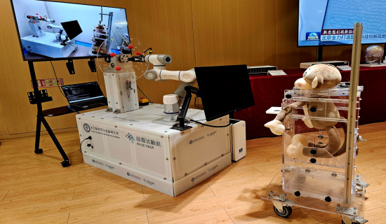 China's pace in brain–computer interface development