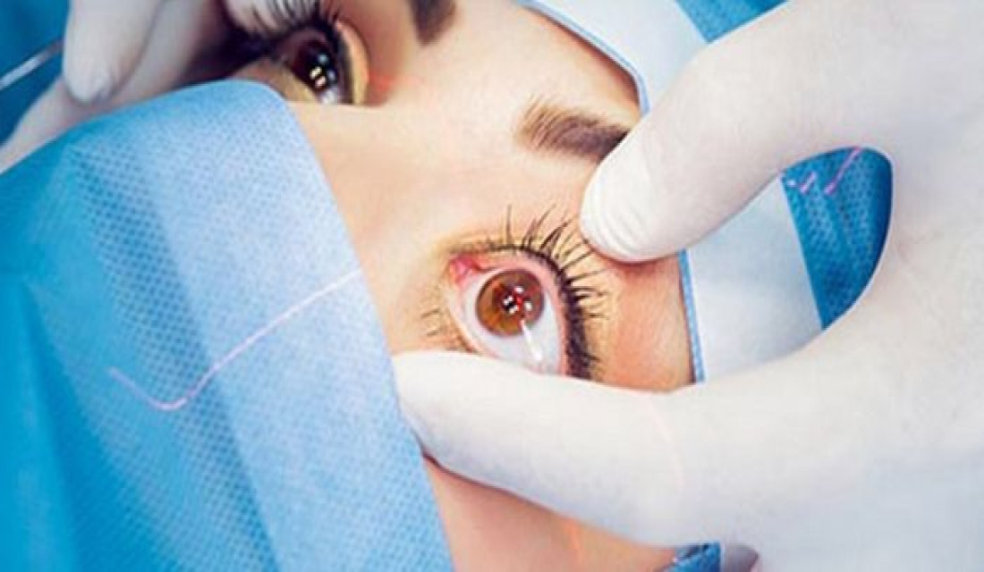 73 senior citizens receive free eye treatment in Parbat