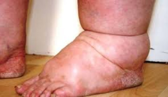 KMC removes 38 truckloads of useless wires