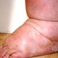 MC Madhesh Province consultation meeting begins in Bardibas