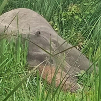 Successful removal of girl’s  facial tumor elates family