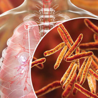 One dies in motorcycle accident